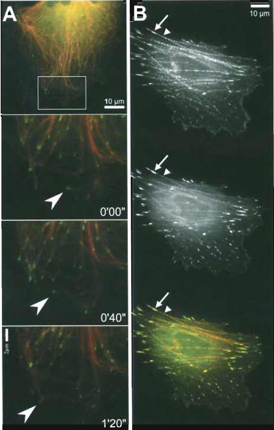 FIGURE 3 Examples of simultaneous visualisation of two distinct cytoskeletal components in the same cell. (A) Dynamics of microtubule plus ends in fish fibroblast CAR. Microinjected Cy3-tubulin (red) combined with ectopically expressed EGFP-EB1 (kind gift of A. S. Akhmanova, Rotterdam; green). Top image, overview. Bottom images, zoom into the boxed region in the overview, subsequent frames, time shown in minutes and seconds. Note that EB1 localises to the tips of growing microtubules (e.g., arrowheads in frames 0'00" and 0'40"), but is absent from pausing or shrinking microtubule ends (e.g., arrowhead in frame 1'20"). (B) EGFP-zyxin expressing CAR cell microinjected with TAMRA-α-actinin: As shown in Fig. 2B, the α-actinin probe (top panel and red in the merged image at the bottom) mainly incorporates along stress fibers (arrowheads) and in focal adhesions (arrows). Zyxin (middle panel and green at the bottom), thought to be recruited to the cytoskeleton via α-actinin binding (Reinhard et at., 1999), shows a similar, although not identical distribution. The merged image (bottom) reveals that zyxin (green) is enriched in focal adhesions, whereas α-actinin (red) targets more prominently to stress fibres, indicating that the subcellular positioning of zyxin is more complex than simple α-actinin-mediated recruitment.