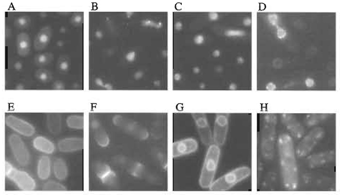 FIGURE 2 Examples of localizations of GFP-fusion proteins. (A) General nuclear staining, (B) nuclear dots, (C) nucleolus, (D) nuclear rim, (E) cell periphery, (F) cell pole and septum, (G) membrane, and (H) cytoplasmic dots. Scale bar: 10 µm.