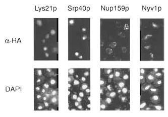 Figure 2 Examples of immunofluorescence patterns
from largescale protein localization studies in 
S. cerevisiae. (Top) Immunofluorescence patterns in
vegetative yeast cells stained with monoclonal
antibodies directed against HA. (Bottom) The same 
cells stained with the DNA-binding dye 4,
6-diamidino-2-phenylindole (DAPI). Staining of the 
nucleus is evident in cells carrying a tagged allele of
the homocitrate synthase Lys21p, while nucleolar 
staining can be seen in cells HA tagged for the 
chaperone Srp40p. HA-tagged Nup159p localizes to 
the nuclear rim, while staining of the vacuole may be 
observed in cells containing a tagged form of the 
v-SNARE Nyvlp.