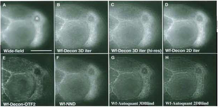 FIGURE 4 Comparing the results of different deconvolution methods on a challenging 3D (60 image) wide-field data set of a Drosophila egg chamber (z-step 0.2µm, x, y pixel size 0.212µm; a ×60 1.2 NA water objective). (A) Single unprocessed wide-field image. (B) The corresponding image plane after 3D iterative, constrained deconvolution of the data set (softWoRx, API: empirical PSF). (C) Deconvolution as in B using a second 60 image 3D data set of the same tissue collected at an x, y pixel size of 0.106gm--higher sampling rate. (D) Two-dimensional iterative constrained deconvolution of the first image data set (softWoRx, API: empirical PSF). Each z plane is deconvolved independently as if it were part of a time-series data set. (E) Deconvolution as in B but using a different PSF (OTF) and more severe smoothing. (F) Using the "nearest neighbours" deconvolution algorithm (softWoRx, API). (G) Using the 3D iterative, "adaptive blind" deconvolution algorithm (Autodeblur, Autoquant-10 iterations; low noise; no spherical aberration; recommended expert settings). (H) Using the 2D iterative, adaptive blind deconvolution algorithm (Autodeblur, Autoquant-15 iterations; low noise; no spherical aberration; recommended expert settings). Scale as for Fig. 3D. Raw data were 12 bit saved as 16 bit; the images shown are 8 bit; with contrast stretched to fill the full dynamic range.