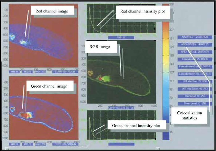 FIGURE 4 Snapshot of a typical image analysis user interface for colocalization analysis. Courtesy of Marco Raimondo and Paola Ramoino, LAMBS, http://www.lambs.it.