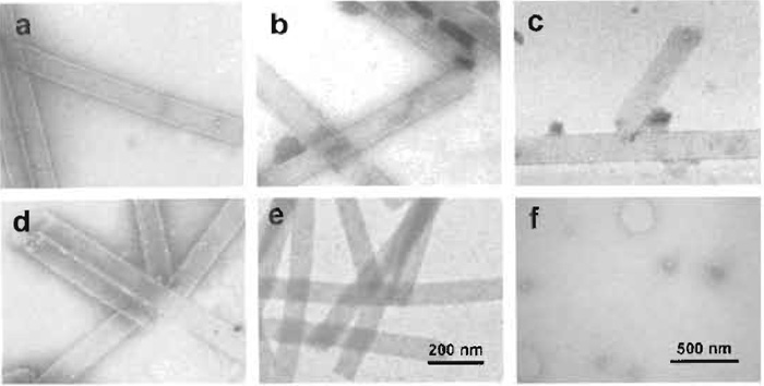 FIGURE 6 Comparative series of prospective negative stains used on bacteriophage T4 polyheads: (a) with 1% uranyl formate, (b) with 2% NH4MoO4, (r with half-saturated NH4VO4, (d) with 1% Na2WO4, and (e) with 2% RhCl3. (f) Liposomes stained with metylamine-vanadate, courtesy of C. Prescianotto-Baschong.