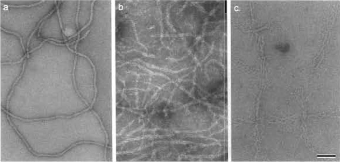 FIGURE 7 Negatively stained human epidermal keratin filaments. (a) Keratin filaments in 10mM Tris, pH 7.5, stained negatively with 0.75% uranyl formate (UF; pH 4.25) appear relatively featureless and compact with a fairly uniform width. (b) In contrast, when the same keratin filaments are stained negatively with 2% sodium phosphotungstate (NaPT; pH 7.0) instead, they locally unravel and exhibit their protofibrillar substructure. (c) Even more dramatic unraveling into their protofibrils occurs when the adsorbed filaments are washed briefly with 10mM phosphate buffer (NaPi; pH 7.0) prior to staining them with 0.75% UF, pH 4.25. Scale bar: 100 nm.