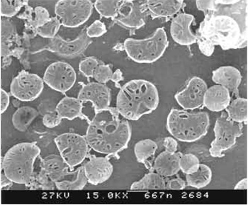 FIGURE 2 Low-power image of cryo-planed block face of a mitochondrial pellet where the internal cristae structure has been exposed. Scale bar: 667 nm.