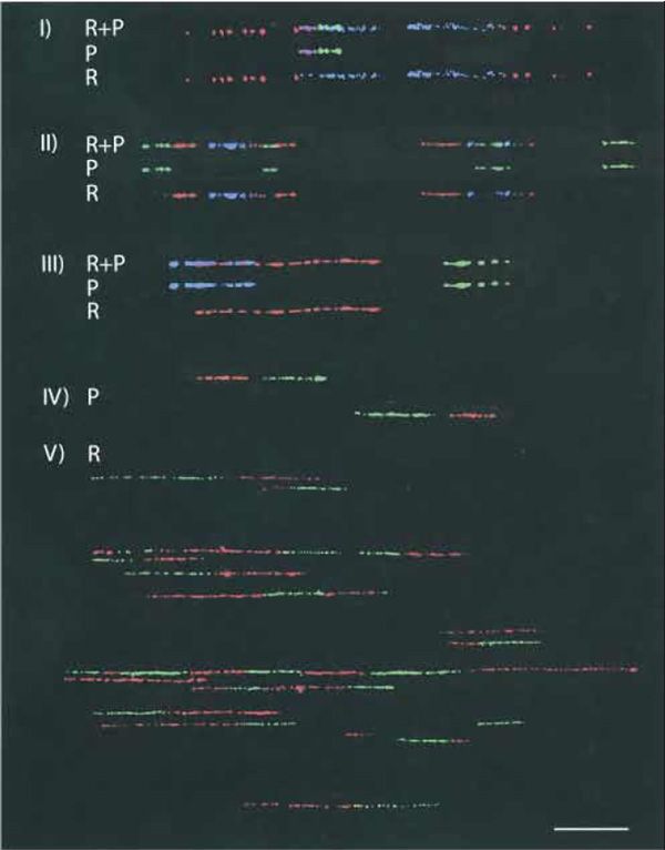 FIGURE 3 Results from all detection schemes. The first molecule in the triad found in I, II, and III are probes (P) and replication (R) together. This molecule has been decomposed digitally to provide probe and replication signals only (we have done this because looking at P + R together can be confusing). In IV, two probe sets on different molecules with different orientation are provided as they were found on the same field of view. A typical field of view with the 40× objective of DNA replication using the paradigm outlined in this article is shown (V). See Table I for details on what colours represent. Bar: 25 µm.