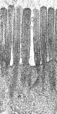 Electron micrograph of microvilli. (× 59,000)