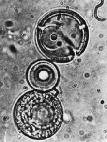 Electron micrograph of proteinoid microspheres. These proteinlike bodies can be produced in the laboratory from polyamino acids and may represent precellular forms. They have definite internal ultrastructure. (1700)