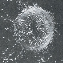 Binding of sperm to the surface of a sea urchin egg. Only one sperm penetrates the egg surface, the others being blocked from entrance by rapid changes in the egg membranes. Unsuccessful sperm are soon lifted away from the egg surface by a newly formed fertilization membrane.