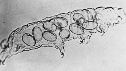 Molted cuticle of a tardigrade, containing a number of fertilized eggs