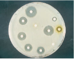A disk diffusion antimicrobial susceptibility test. If the clear zones of growth inhibition around disks are of a certain diameter, the organism is susceptible to the antimicrobial agent in the disk.