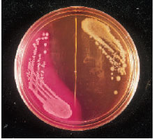 A MacConkey agar plate with Escherichia coli (pink, lactosefermenting colonies) growing on the left-hand side and a Salmonella sp. (colorless, lactose nonfermenting colonies) on the right.