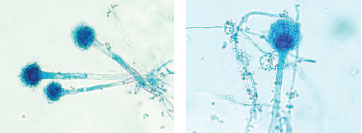 Lactophenol cotton blue coverslip preparation from a slide culture of Aspergillus fumigatus. At low power (×100) magnification (left), three spore-bearing structures can be seen. At higher power (×400) magnification (right), the characteristics that permit genus and species identification are clearly visualized.