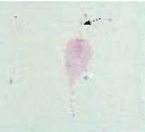 Trichomonas vaginalis in a Gram stain of vaginal secretions. At least one flagellum (arrow) can be clearly seen. Most other parasites do not stain with the Gram stain.