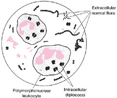 Diagram of a microscopic field showing intracellular diplococci within polymorphonuclear cells. In cervical smears,