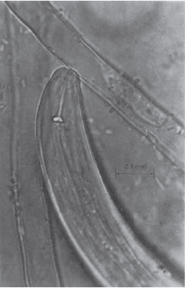 Figure 14.27 Nematode feeding : note the spear inside the mouth, used to penetrate plant tissues